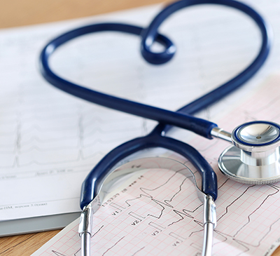 Global Cardiac Arrhythmias Therapeutics Market 2019-2023